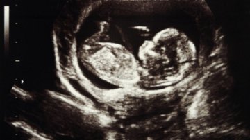 科学家研制微型机器人 可在子宫内为胎儿做手术