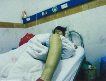 陕西孕妇遭强制引产续：计生局长等3官员被停职