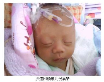 爱肝一生高校志愿者 救助胆闭宝宝公益活动