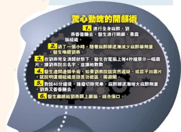 现代刮骨疗毒 脑袋切开还能聊天