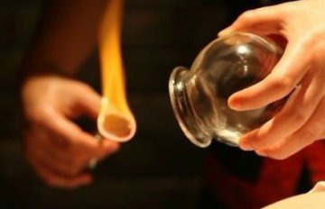 拔罐驱寒除湿 拔罐对身体的五大好处