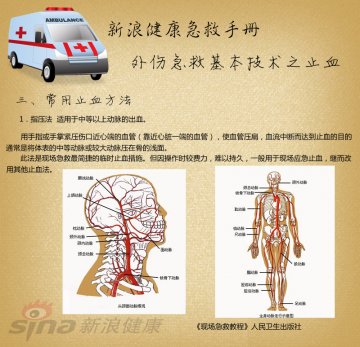 常用止血方法：指压法