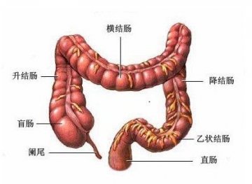 不是癌症的顽症——溃疡性结肠炎