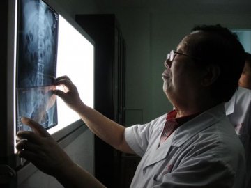 自然疗法治脊椎