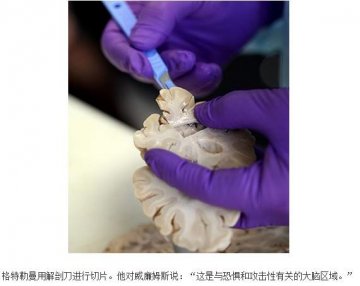 高清解析人脑解剖全过程