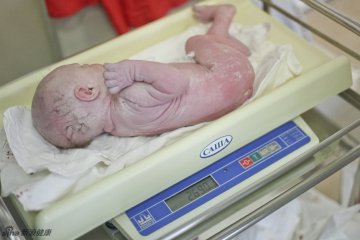 2012年11月,俄罗斯.剖腹产分娩手术全过程