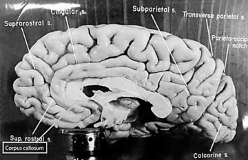 科学家揭开爱因斯坦大脑之谜