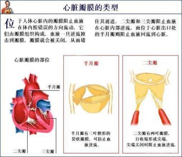 心脏瓣膜的类型
