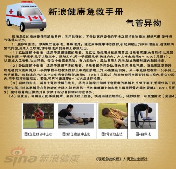 气管异物急救措施