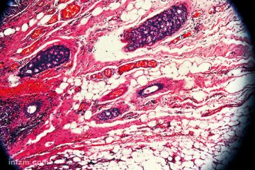 英国科学家首次解析癌症发生发展全过程