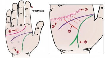 24种手相揭示疾病征兆