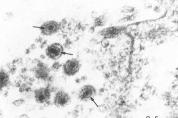 人类免疫缺陷病病毒（1）