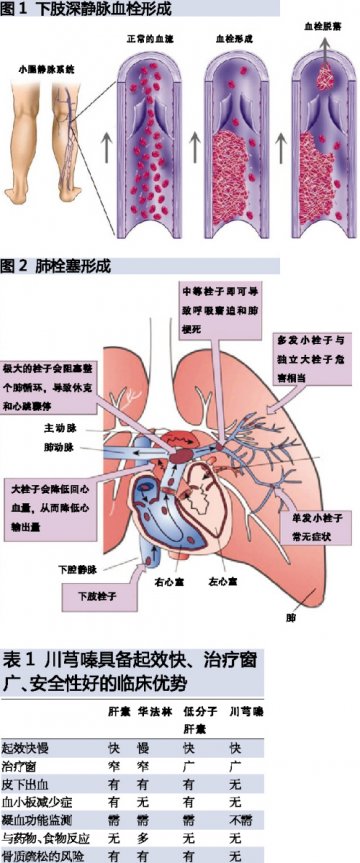 川芎嗪：“沉默杀手”终结者