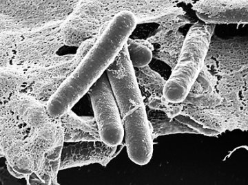 学术界担心出版新肉毒杆菌科学细节引发生物武器危机