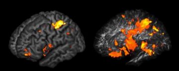 PNAS：科学家绘制出影响人类智力大脑结构图