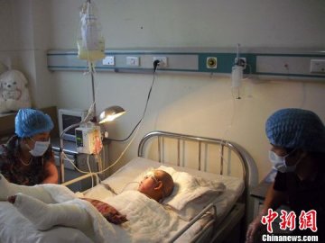 农民工“割皮救女” 为省千元放弃全身麻醉