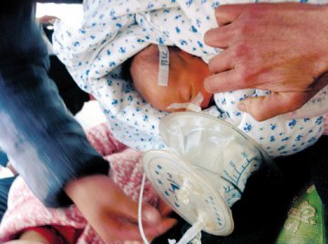 婴儿食道闭锁或将饿死 无钱医治父亲欲将其送人