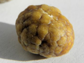 生胆石三高危因素