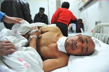 男子饮酒过量摔倒被狗咬伤喉咙