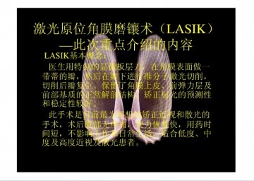 lasik1