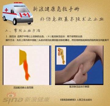 指压止血方法：肱动脉压迫法