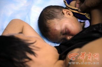 男子偷东西被抓赖儿子 20巴掌将其打进医院