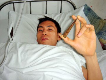 匕首藏在胸腔