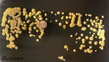 亲眼看看手机上的细菌