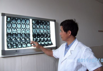 血管瘤不可怕，生物等离子微创技术消灭它