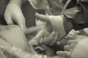 剖腹产宝宝出生瞬间
