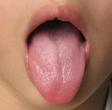 正常舌苔