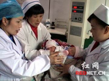 双胞胎村降生一对连体女婴