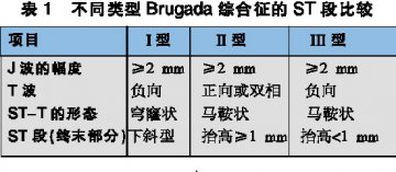 突发晕厥，小心Brugada综合征