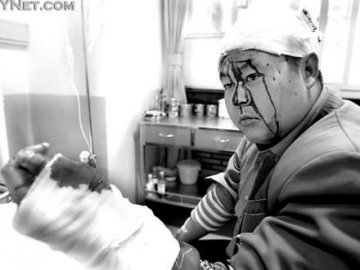 北京雅秀门前商贩为争夺顾客持刀砍人