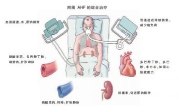 急性心衰“狭路相逢”，评估“敌情”迅者胜