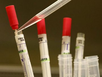 埃博拉试验性新药的是与非