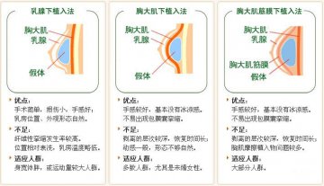 实拍国外隆胸手术全程