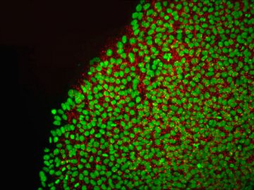 日本科学家利用胚胎干细胞治疗糖尿病