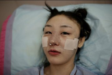 韩国摄影师记录5位模特血腥整容蜕变全程