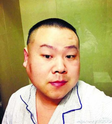 岳云鹏生瘤急做手术