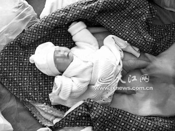 孕妈多次B超产检仍生出畸形儿 医院称无责任