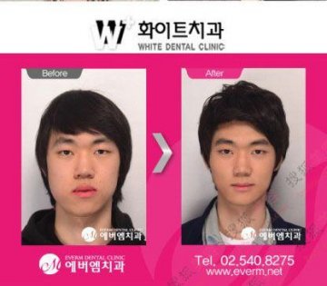 31个惊人韩国整容案例