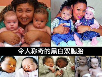 揭秘神奇的黑白双胞胎