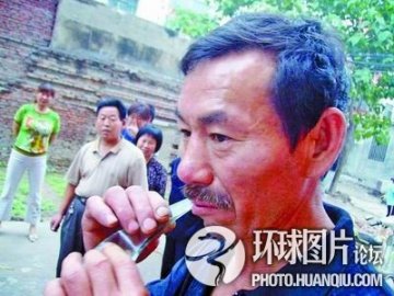 男子吃玻璃砖头三十六年