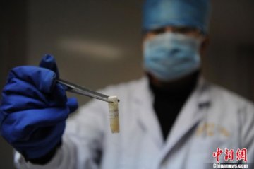 探访吉林精子库:八成为学生 合格率25%