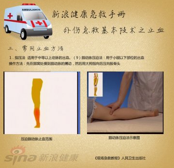 指压止血方法：腘动脉压迫法