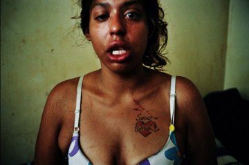 Babygirl身上的的抓痕是她在监狱里跟另一名女人打架所致