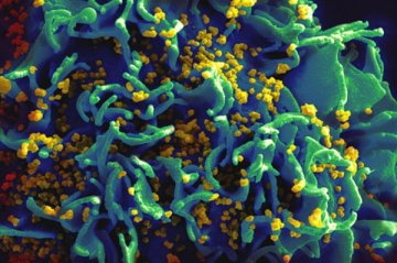 美疾控中心CDC建议推广使用新型HIV检测方法