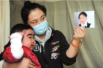3岁男童患怪病面临失明 长年服用药物成“毛孩”