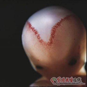 精子发育成胎儿全过程